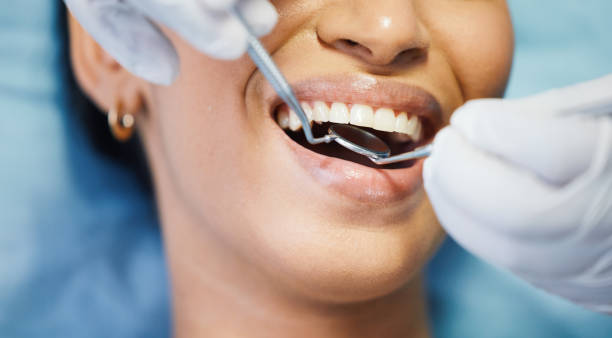Best Emergency Dental Care for Abscessed Tooth in Belmont Estates, VA
